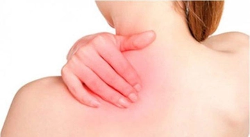 Yanık Sonrası Kaşıntı Belirtileri ve Tedavisi Yanık Sonrası Kaşıntı Belirtileri ve Tedavisi